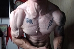 hot veins