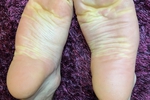 FEETLOVERS