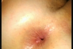 My hole