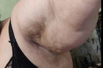 My armpits