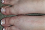Lollipop toes