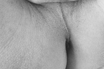 Ass