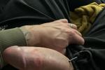 HandT