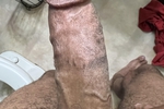 dick