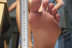 giant foot for small you