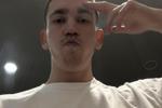 I have no hair 12 pic