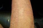 michael — Girth!