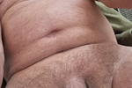 new