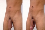 Left or right?