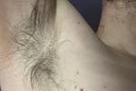 My Sweaty Pits