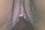 Gaping