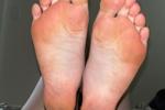 Feet set