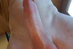 dick pic