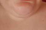 Me