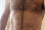 Bare chest