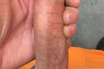 19CM