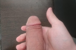 dicks