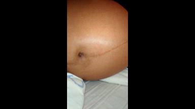 preg