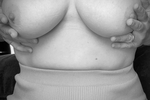 Breast