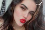 kiss