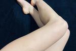 legs
