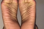 Welcome Wrinkles