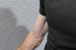 CK Arm