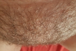 Hairy pussy detail / 6 pictures