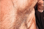 Pinch