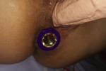 Anal