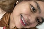 Me smile with braces