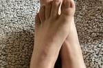 Bare feet