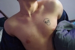 Hot body