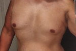Nudes