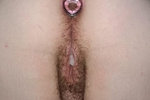 Up close and naked