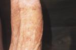 dick pic
