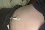 body