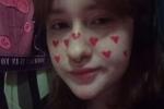 kiss you