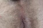 My hole
