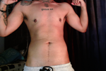 muscle