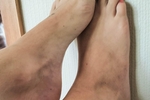 more feet ,3