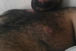 Hairy chest