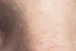 Eyes