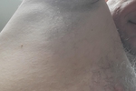 arm pit and nipple