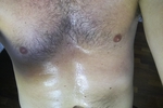 AFTER RUNNING