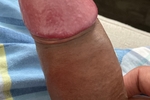cock