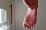 Feet photoset