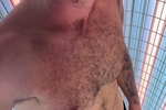 Alpha