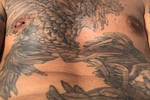 nipple piercing
