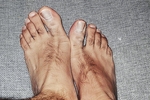feet